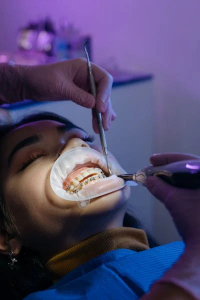 Root Canal 101: Facts About This Tooth-Saving Treatment