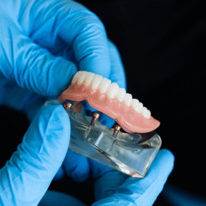 Overdentures (Implant-Supported Dentures) - Maple Dental