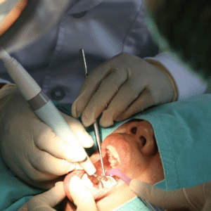 Scaling and Polishing (Dental Cleaning) - Maple Dental
