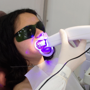 Teeth Whitening - Maple Dental