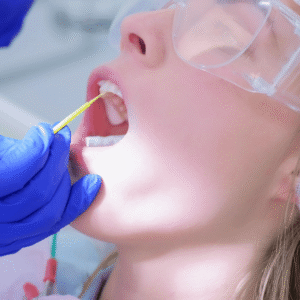 Topical Fluoride - Maple Dental