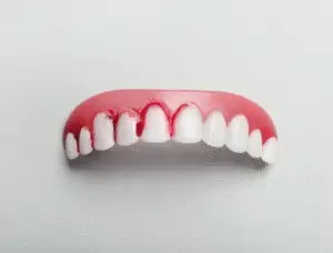 Gum Disease - Maple Dental (Kovan)